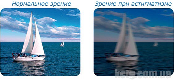 Ухудшение зрения из за очков